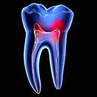 Endodontia