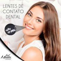 Lentes de contato dentais