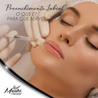 Preenchimento Facial e Labial